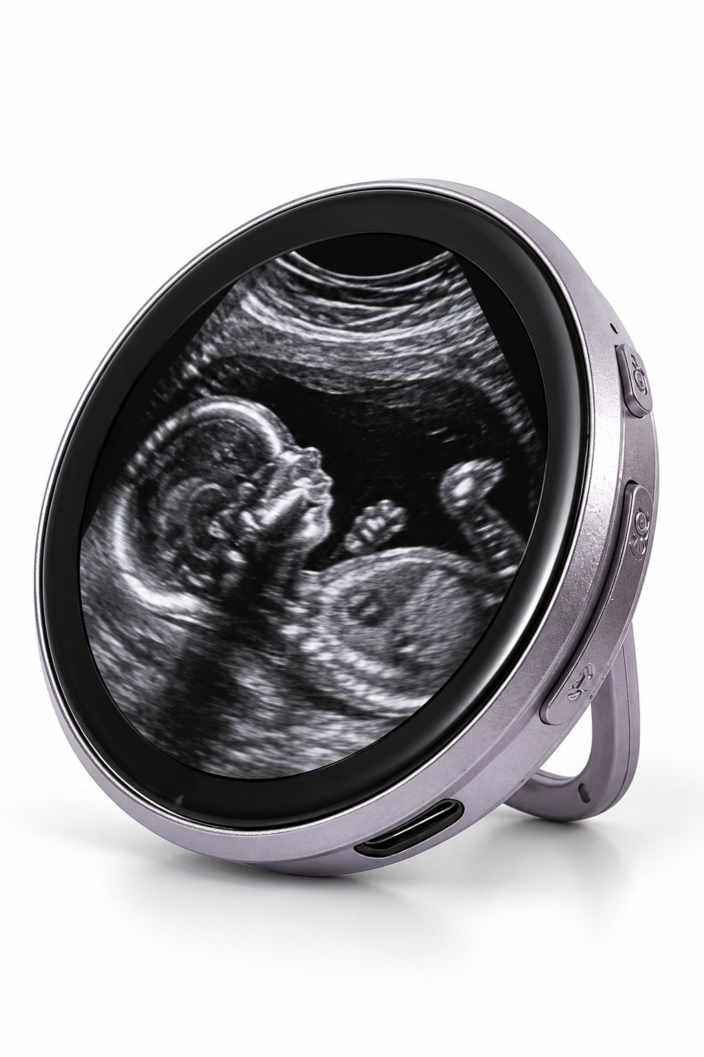 FirstGlimpse™ — Digital Ultrasound Keepsake